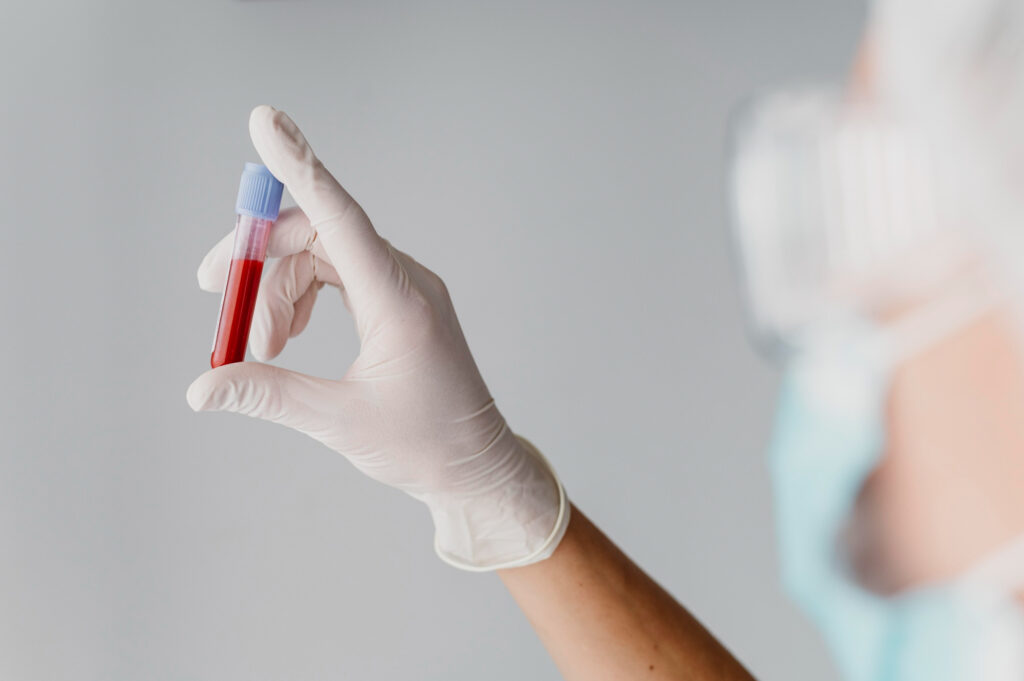 A vial of blood held by a doctor wearing a white glove.