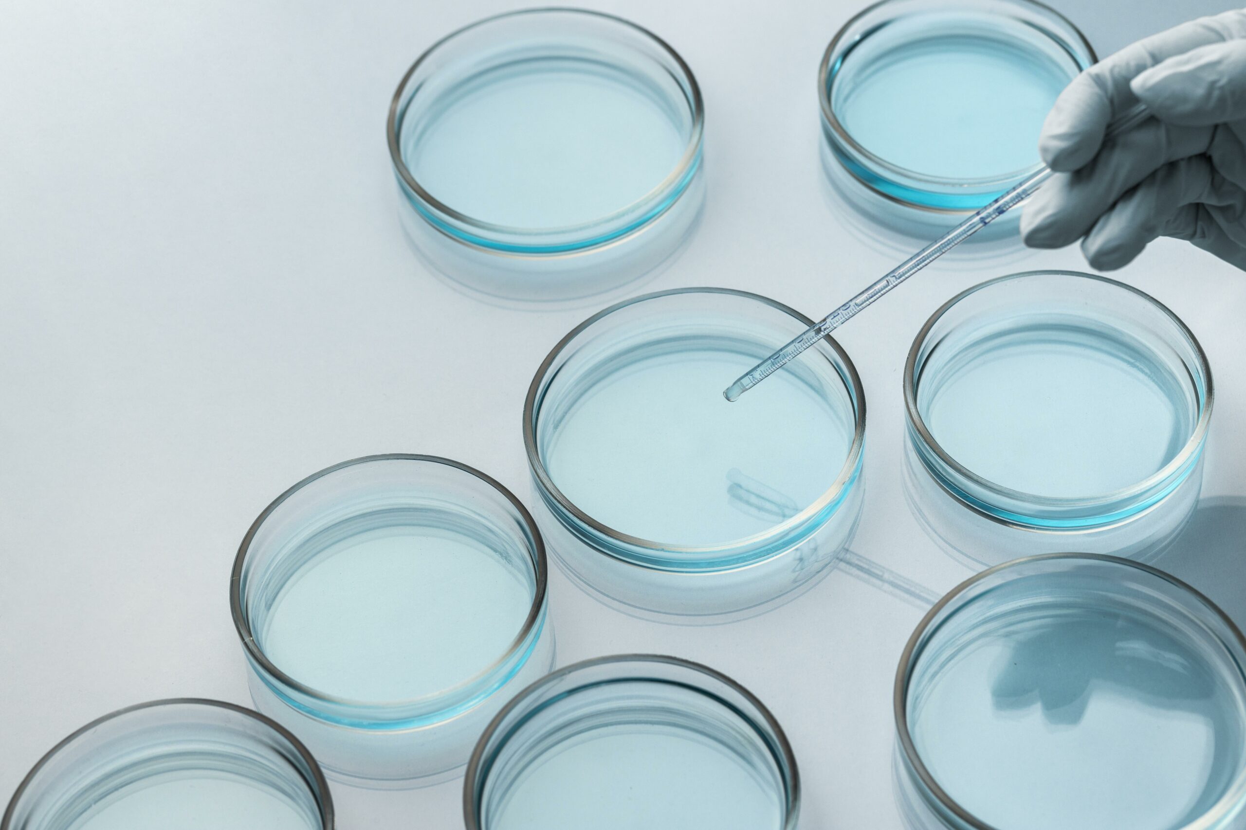 Petri dishes testing bacteria and cell immunity